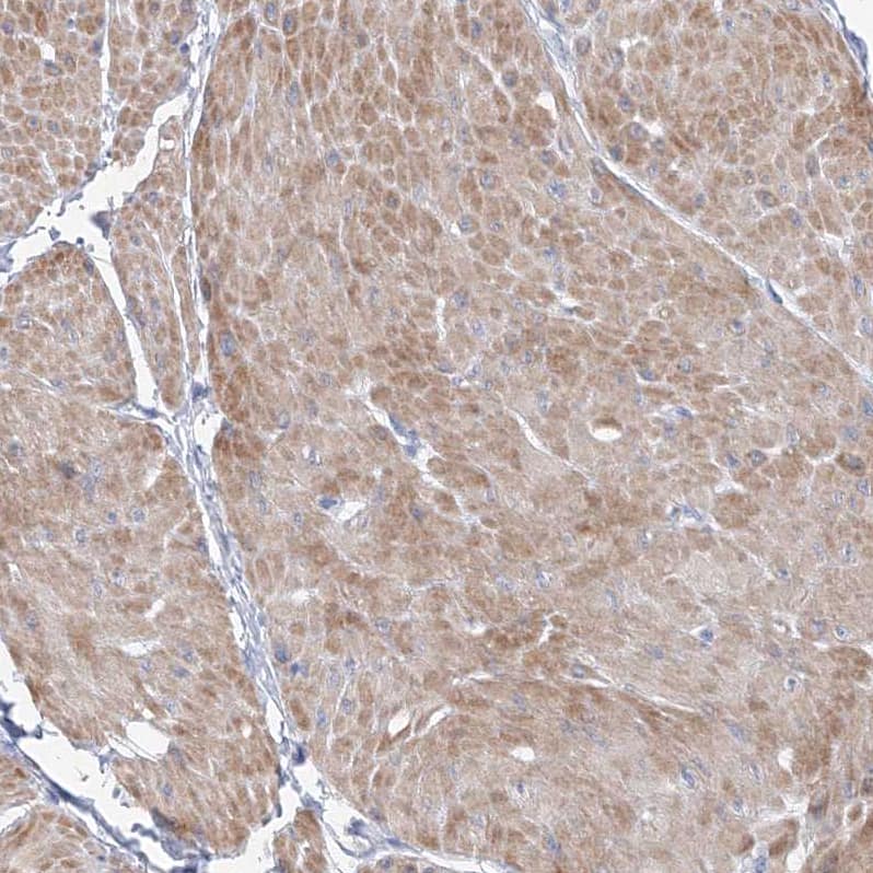 OSBPL6 Antibody - BSA Free Immunohistochemistry-Paraffin: OSBPL6 Antibody [NBP1-82475]