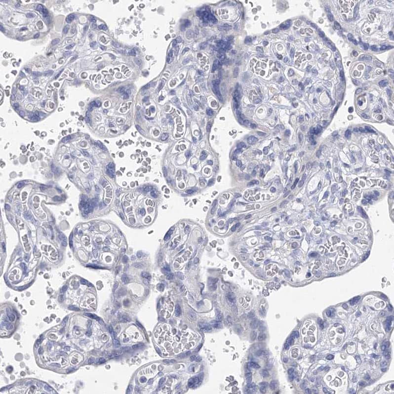 OSBPL6 Antibody - BSA Free Immunohistochemistry-Paraffin: OSBPL6 Antibody [NBP1-82475]