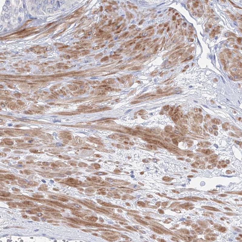 OSBPL6 Antibody - BSA Free Immunohistochemistry-Paraffin: OSBPL6 Antibody [NBP1-82475]