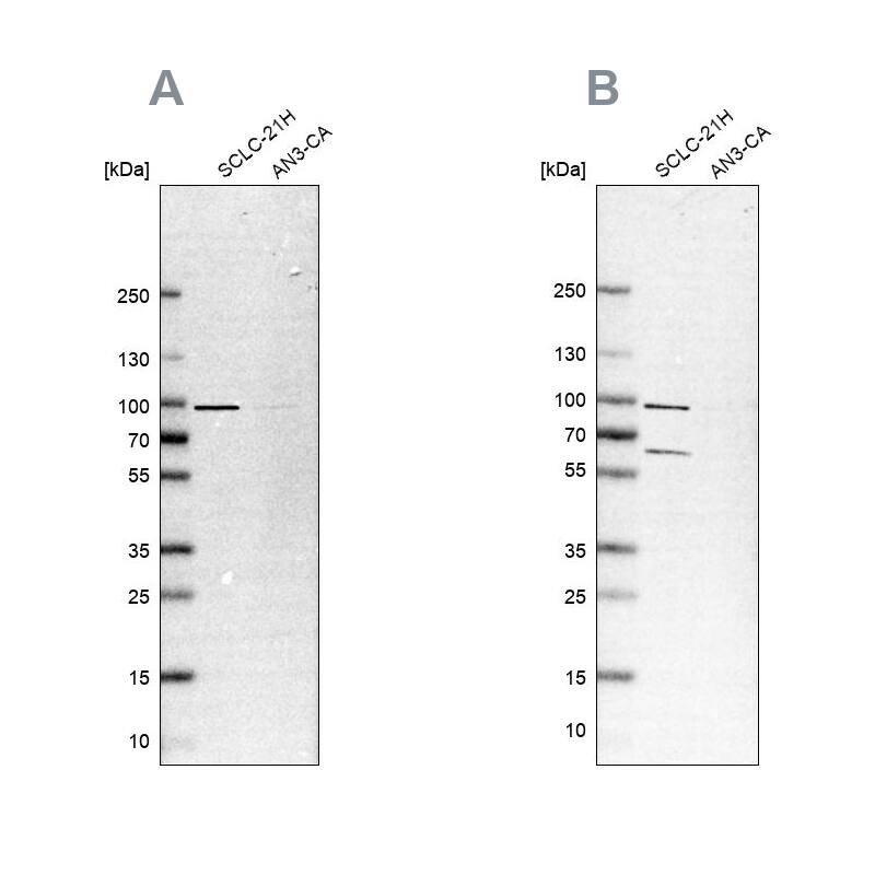 PNPT1 Antibody Western Blot: PNPT1 Antibody Antibody [NBP1-82485]