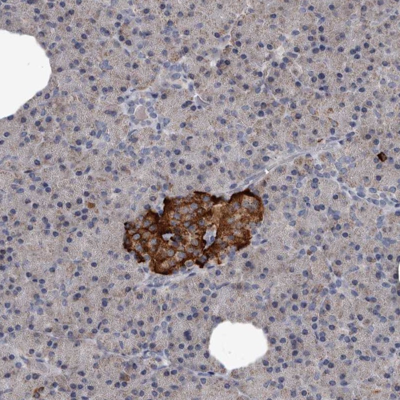 GREB1 Antibody Immunohistochemistry-Paraffin: Centrin 2 Antibody [NBP1-81499]