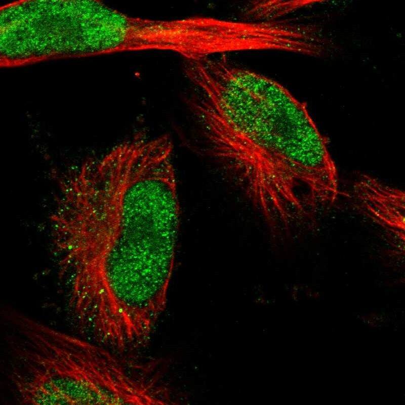 SDCCAG10 Antibody - BSA Free Immunocytochemistry/ Immunofluorescence: SDCCAG10 Antibody [NBP1-82509]