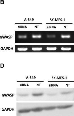 N-WASP Antibody