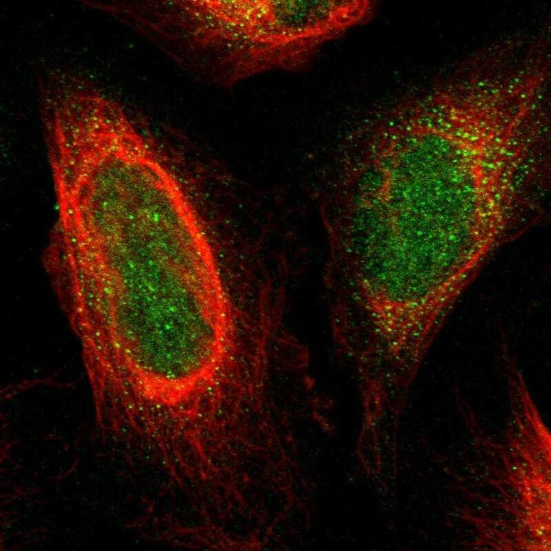 Plexin A1 Antibody - BSA Free Immunocytochemistry/ Immunofluorescence: Plexin A1 Antibody [NBP1-82544]