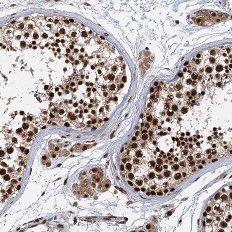 NHN1 Antibody - BSA Free Immunohistochemistry-Paraffin: NHN1 Antibody [NBP1-82570]