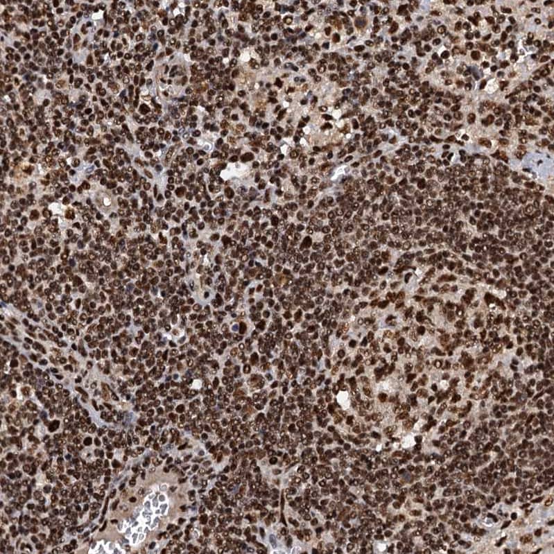 NHN1 Antibody - BSA Free Immunohistochemistry-Paraffin: NHN1 Antibody [NBP1-82570]