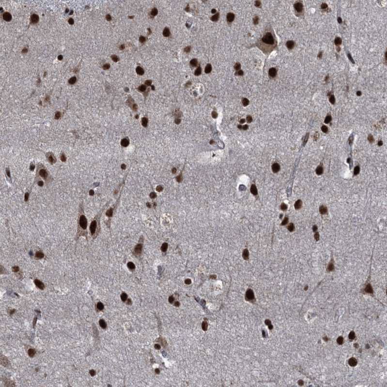 NHN1 Antibody - BSA Free Immunohistochemistry-Paraffin: NHN1 Antibody [NBP1-82570]