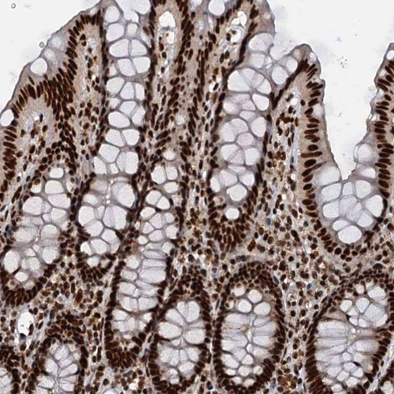 NHN1 Antibody - BSA Free Immunohistochemistry-Paraffin: NHN1 Antibody [NBP1-82570]