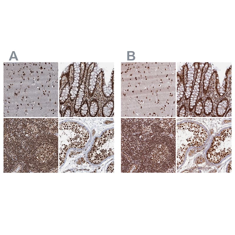NHN1 Antibody - BSA Free Immunohistochemistry-Paraffin: NHN1 Antibody [NBP1-82570]