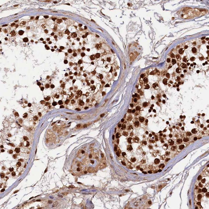 NHN1 Antibody - BSA Free Immunohistochemistry-Paraffin: NHN1 Antibody [NBP1-82571]