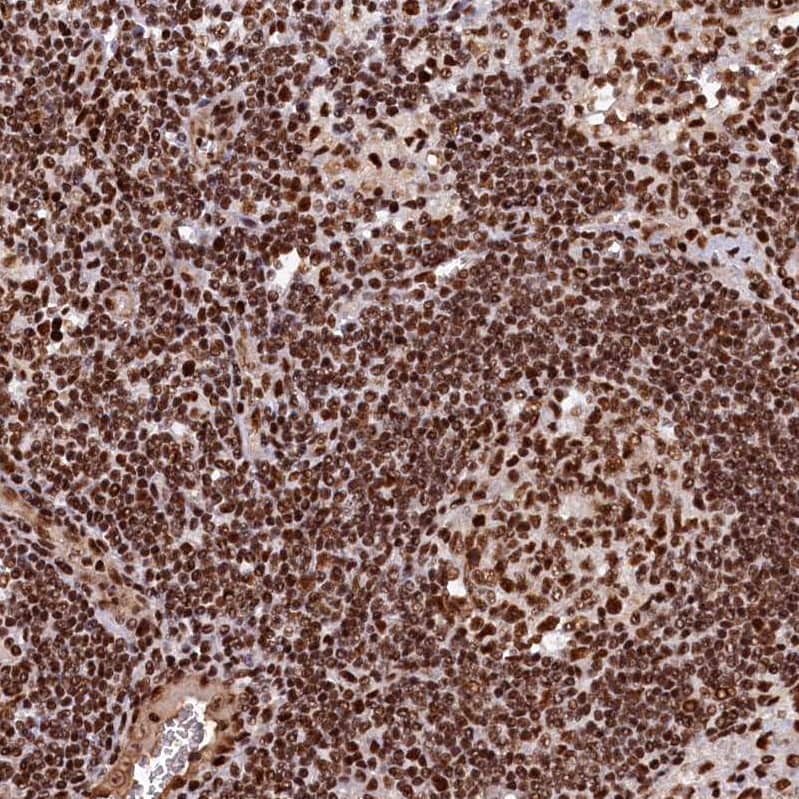 NHN1 Antibody - BSA Free Immunohistochemistry-Paraffin: NHN1 Antibody [NBP1-82571]