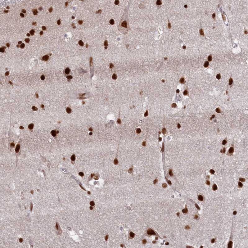 NHN1 Antibody - BSA Free Immunohistochemistry-Paraffin: NHN1 Antibody [NBP1-82571]