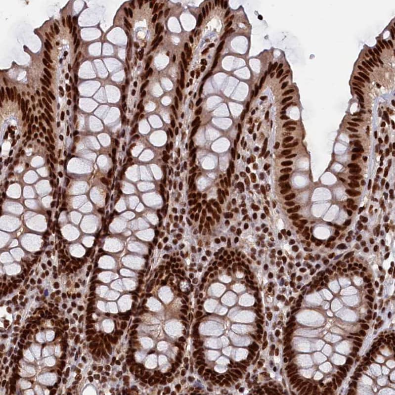 NHN1 Antibody - BSA Free Immunohistochemistry-Paraffin: NHN1 Antibody [NBP1-82571]