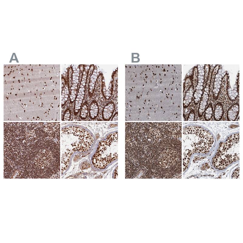 NHN1 Antibody - BSA Free Immunohistochemistry-Paraffin: NHN1 Antibody [NBP1-82571]
