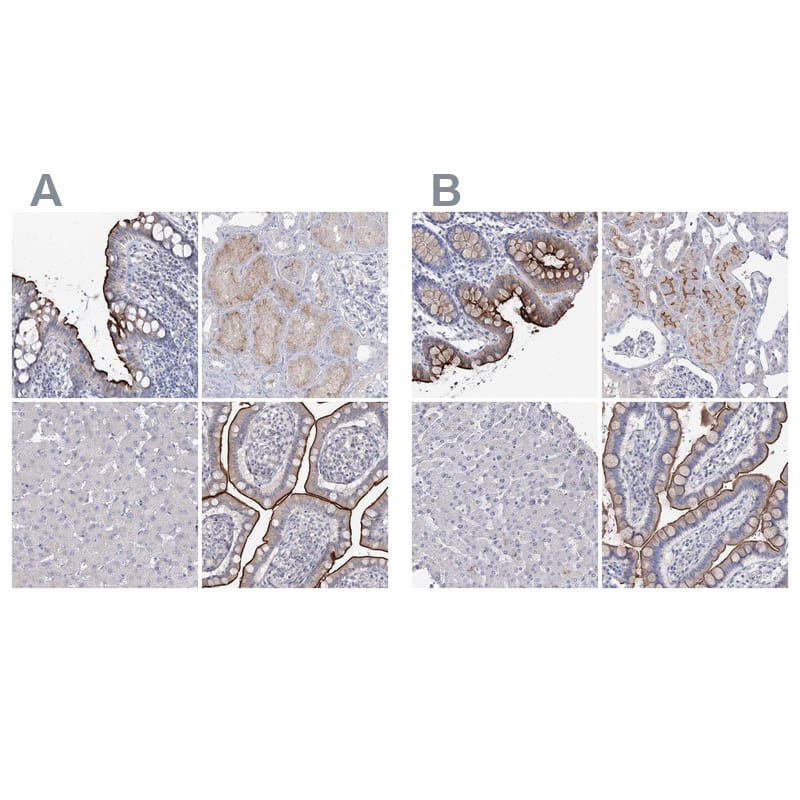 NHE3/SLC9A3 Antibody - BSA Free Immunohistochemistry-Paraffin: NHE3/SLC9A3 Antibody [NBP1-82574]