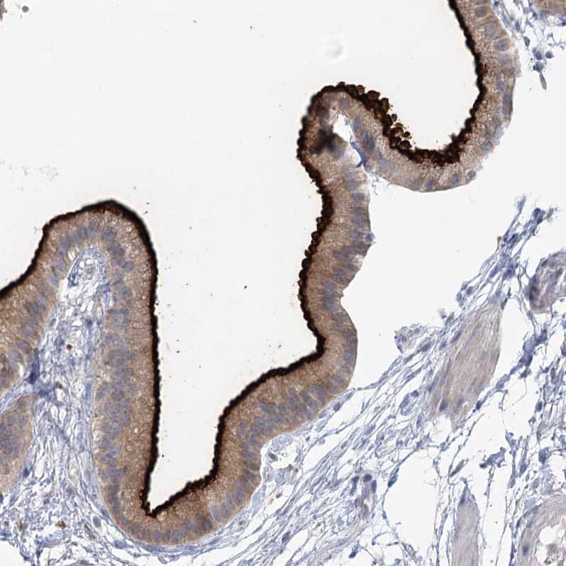NHE3/SLC9A3 Antibody - BSA Free Immunohistochemistry-Paraffin: NHE3/SLC9A3 Antibody [NBP1-82574]