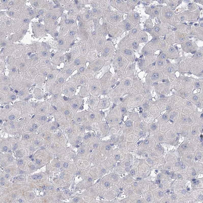 NHE3/SLC9A3 Antibody - BSA Free Immunohistochemistry-Paraffin: NHE3/SLC9A3 Antibody [NBP1-82574]