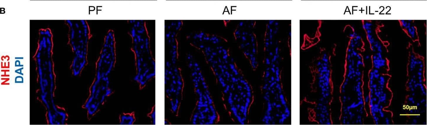 NHE3/SLC9A3 Antibody - BSA Free