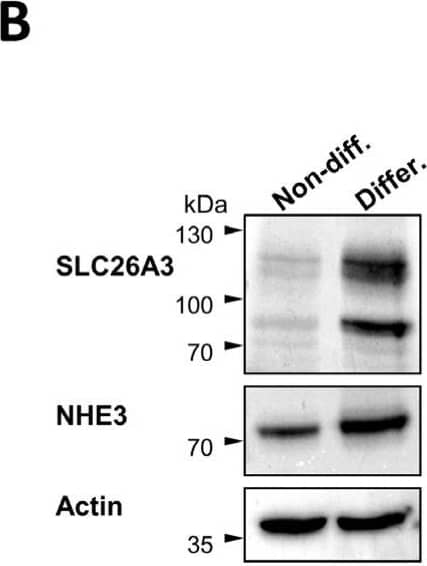 NHE3/SLC9A3 Antibody - BSA Free
