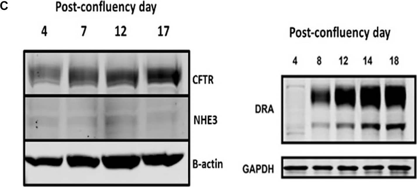 NHE3/SLC9A3 Antibody - BSA Free