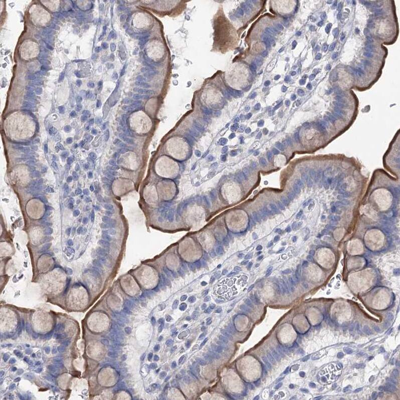 NHE3/SLC9A3 Antibody - BSA Free Immunohistochemistry-Paraffin: NHE3/SLC9A3 Antibody [NBP1-82575]