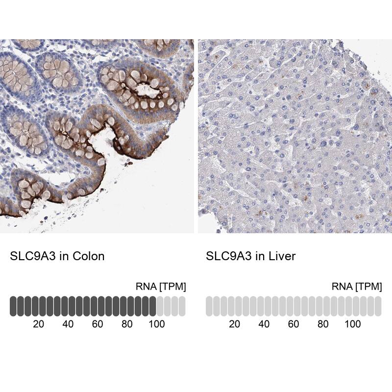 NHE3/SLC9A3 Antibody - BSA Free Immunohistochemistry-Paraffin: NHE3/SLC9A3 Antibody [NBP1-82575]