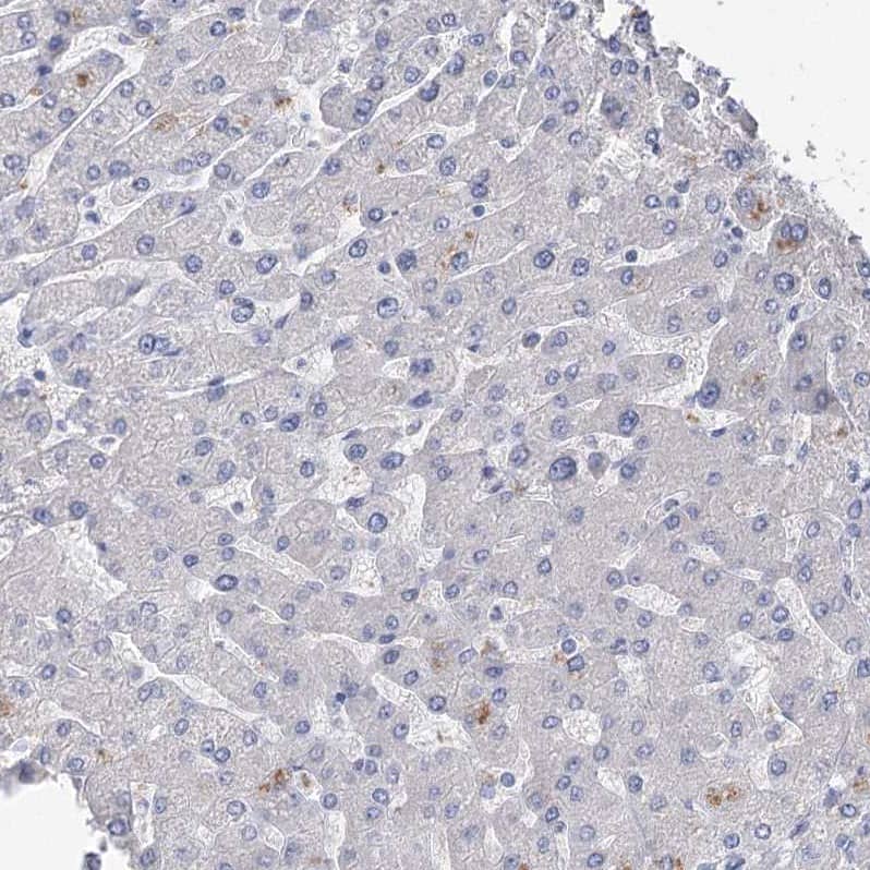 NHE3/SLC9A3 Antibody - BSA Free Immunohistochemistry-Paraffin: NHE3/SLC9A3 Antibody [NBP1-82575]