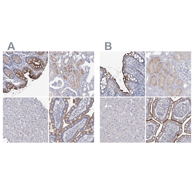 NHE3/SLC9A3 Antibody - BSA Free Immunohistochemistry-Paraffin: NHE3/SLC9A3 Antibody [NBP1-82575]
