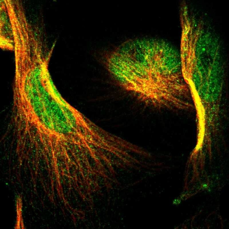 NFATC2/NFAT1 Antibody - BSA Free Immunocytochemistry/ Immunofluorescence: NFATC2/NFAT1 Antibody [NBP1-82583]