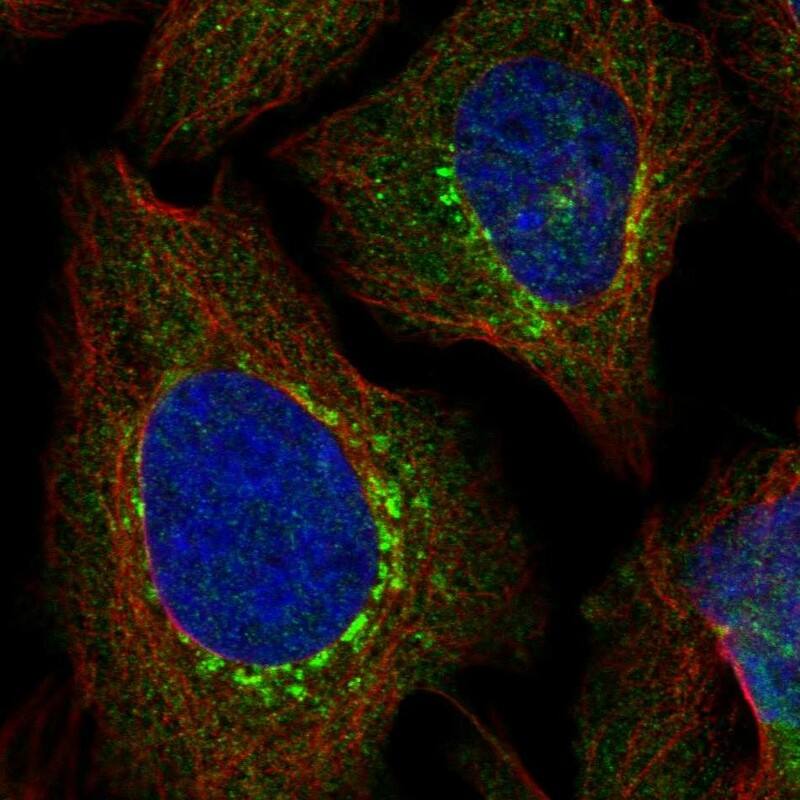 EVI5 Antibody - BSA Free Immunocytochemistry/ Immunofluorescence: EVI5 Antibody [NBP1-82596]