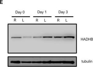 HADHB Antibody