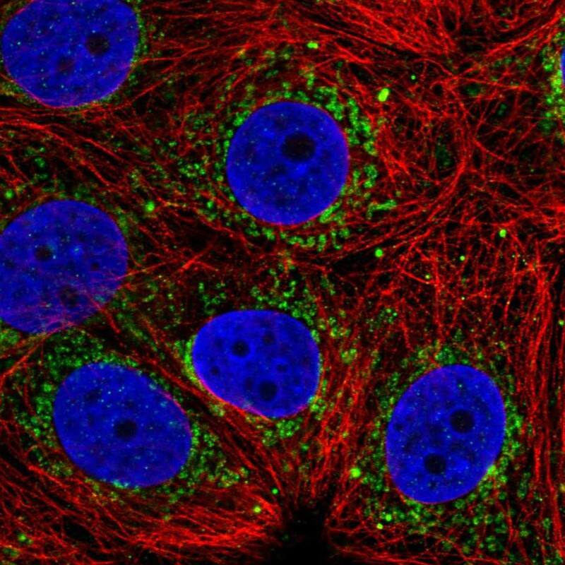ALDH6A1 Antibody - BSA Free Immunocytochemistry/ Immunofluorescence: ALDH6A1 Antibody [NBP1-82634]