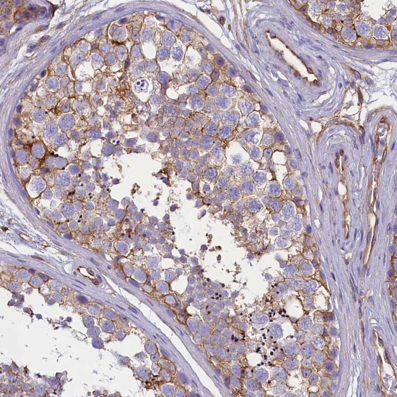 CD99 Antibody - BSA Free Immunohistochemistry-Paraffin: CD99 Antibody [NBP1-82650]