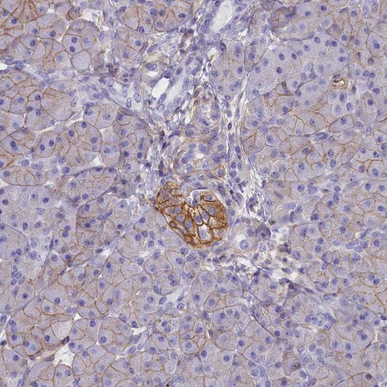 CD99 Antibody - BSA Free Immunohistochemistry-Paraffin: CD99 Antibody [NBP1-82650]