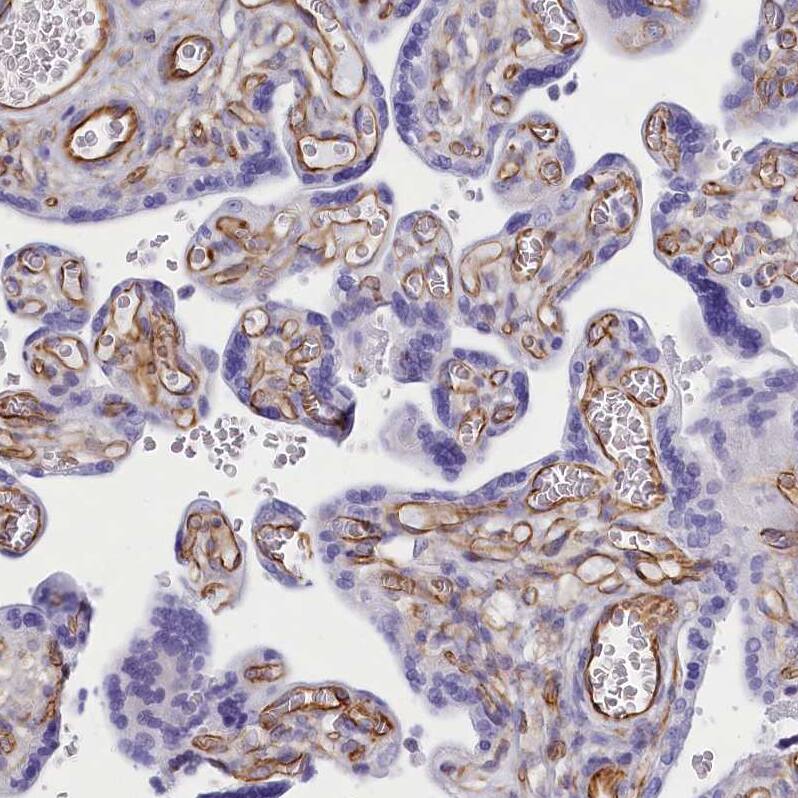 CD99 Antibody - BSA Free Immunohistochemistry-Paraffin: CD99 Antibody [NBP1-82650]