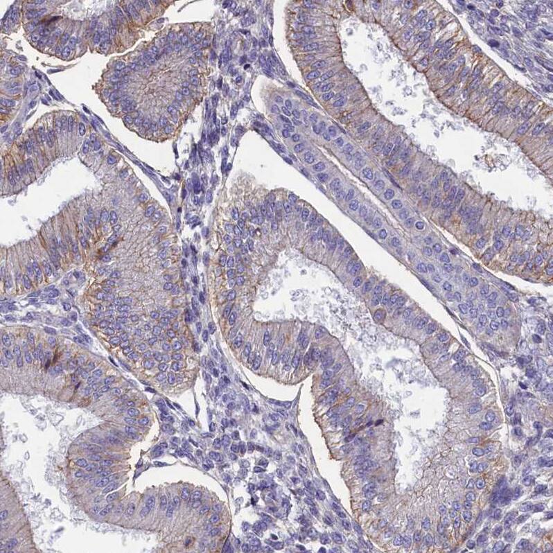 CD99 Antibody - BSA Free Immunohistochemistry-Paraffin: CD99 Antibody [NBP1-82650]
