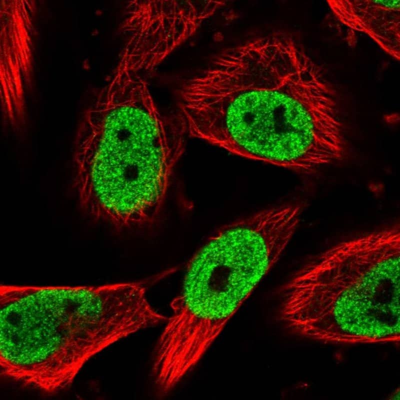 NUP88 Antibody - BSA Free Immunocytochemistry/ Immunofluorescence: NUP88 Antibody [NBP1-82658]