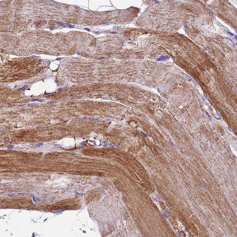 NDUFA8 Antibody - BSA Free Immunohistochemistry-Paraffin: NDUFA8 Antibody [NBP1-82661]