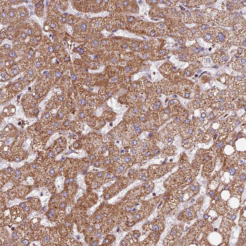 NDUFA8 Antibody - BSA Free Immunohistochemistry-Paraffin: NDUFA8 Antibody [NBP1-82661]