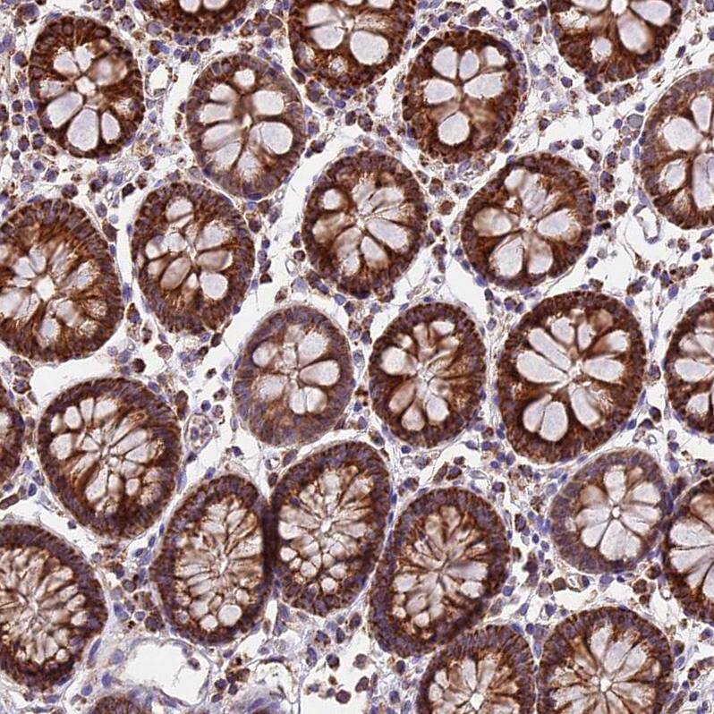 NDUFA8 Antibody - BSA Free Immunohistochemistry-Paraffin: NDUFA8 Antibody [NBP1-82661]
