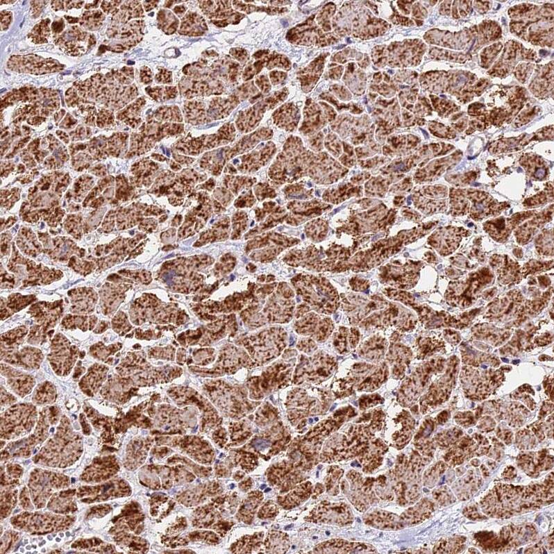 NDUFA8 Antibody - BSA Free Immunohistochemistry-Paraffin: NDUFA8 Antibody [NBP1-82661]