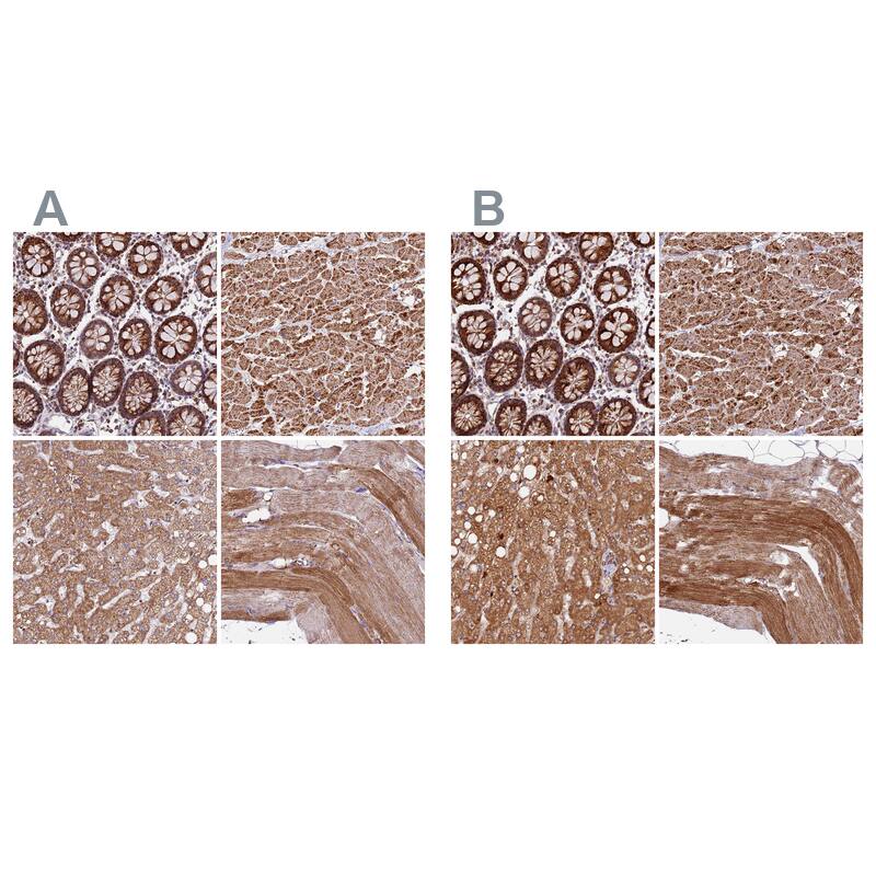 NDUFA8 Antibody - BSA Free Immunohistochemistry-Paraffin: NDUFA8 Antibody [NBP1-82661]
