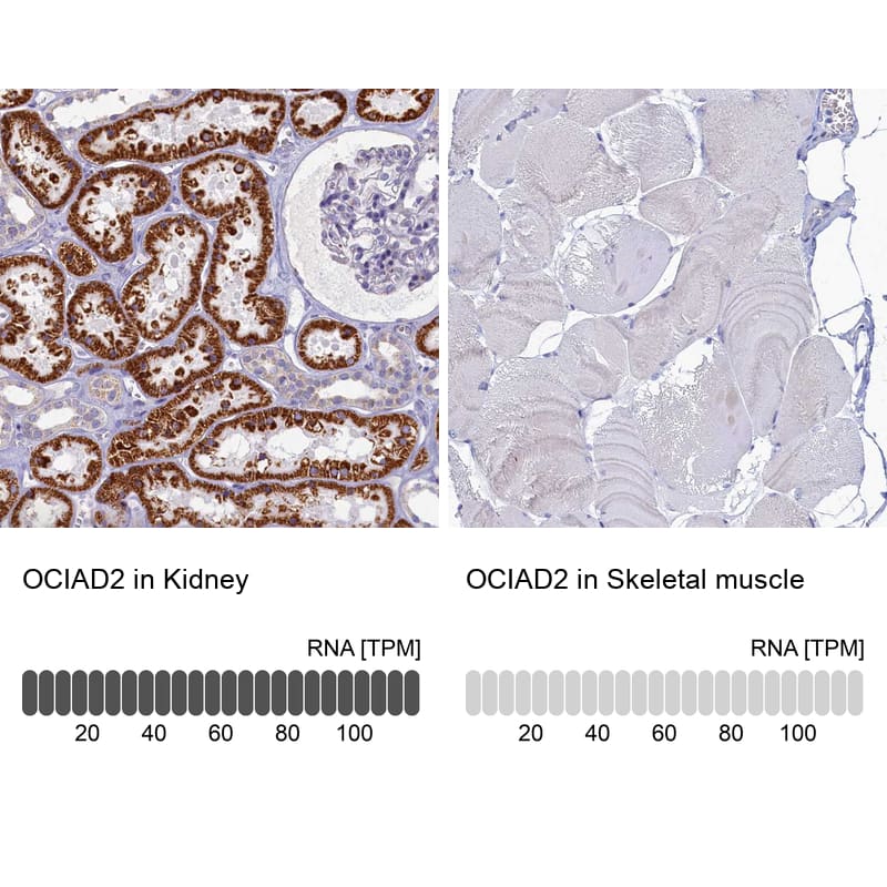 OCIAD2 Antibody - BSA Free Immunohistochemistry-Paraffin: OCIAD2 Antibody [NBP1-82683]