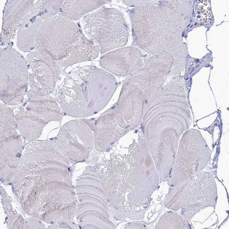 OCIAD2 Antibody - BSA Free Immunohistochemistry-Paraffin: OCIAD2 Antibody [NBP1-82683]