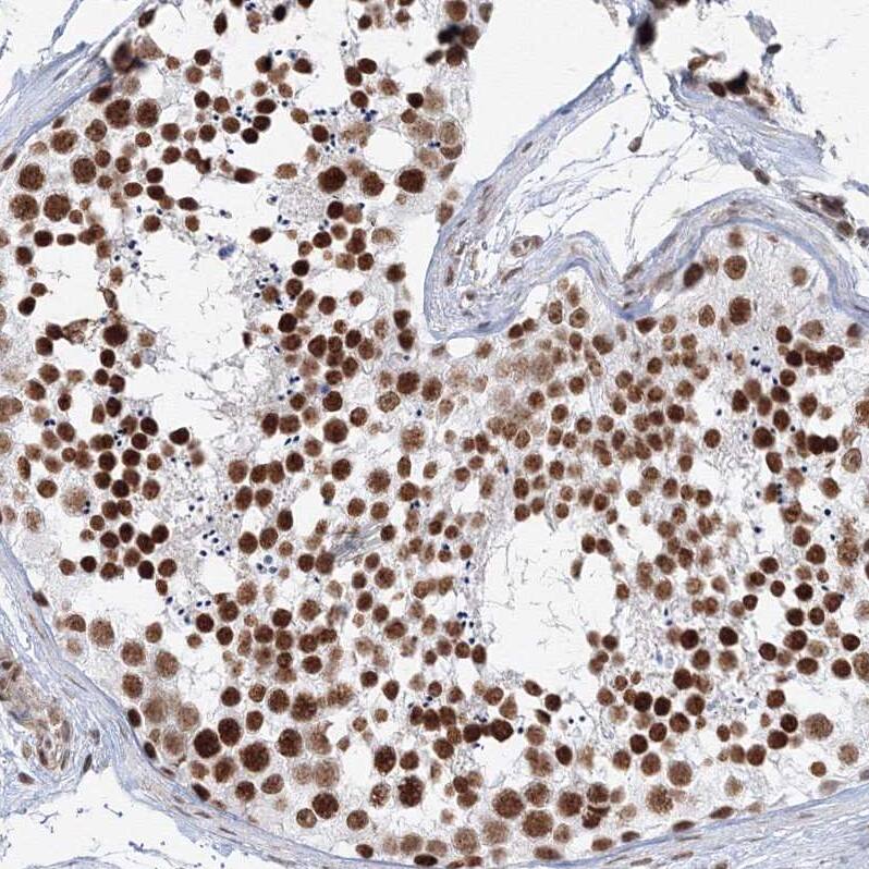 ZNF638 Antibody - BSA Free Immunohistochemistry-Paraffin: ZNF638 Antibody [NBP1-82730]
