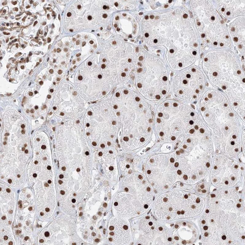 ZNF638 Antibody - BSA Free Immunohistochemistry-Paraffin: ZNF638 Antibody [NBP1-82730]
