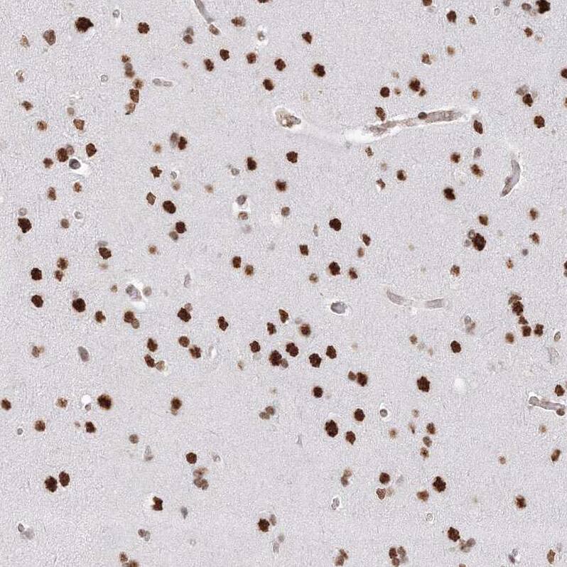 ZNF638 Antibody - BSA Free Immunohistochemistry-Paraffin: ZNF638 Antibody [NBP1-82730]