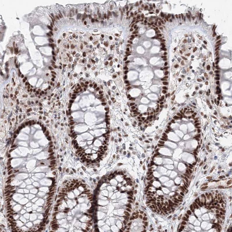 ZNF638 Antibody - BSA Free Immunohistochemistry-Paraffin: ZNF638 Antibody [NBP1-82730]