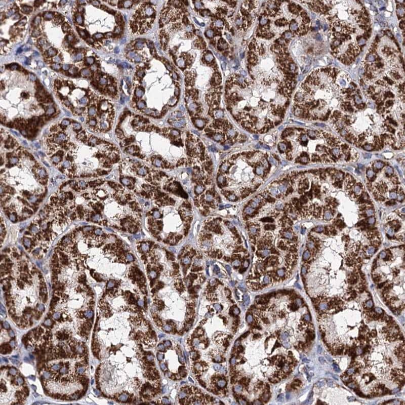ACAD9 Antibody - BSA Free Immunohistochemistry-Paraffin: ACAD9 Antibody [NBP1-82749]