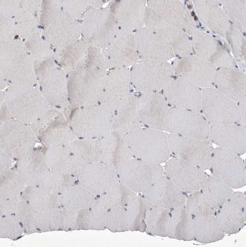 Siglec-10 Antibody - BSA Free Immunohistochemistry-Paraffin: Siglec-10 Antibody [NBP1-82759]